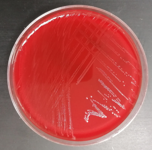 Streptococcus uberis in laboratory culture. Image courtesy and copyright of James Breen BVSc PhD DCHP MRCVS. 